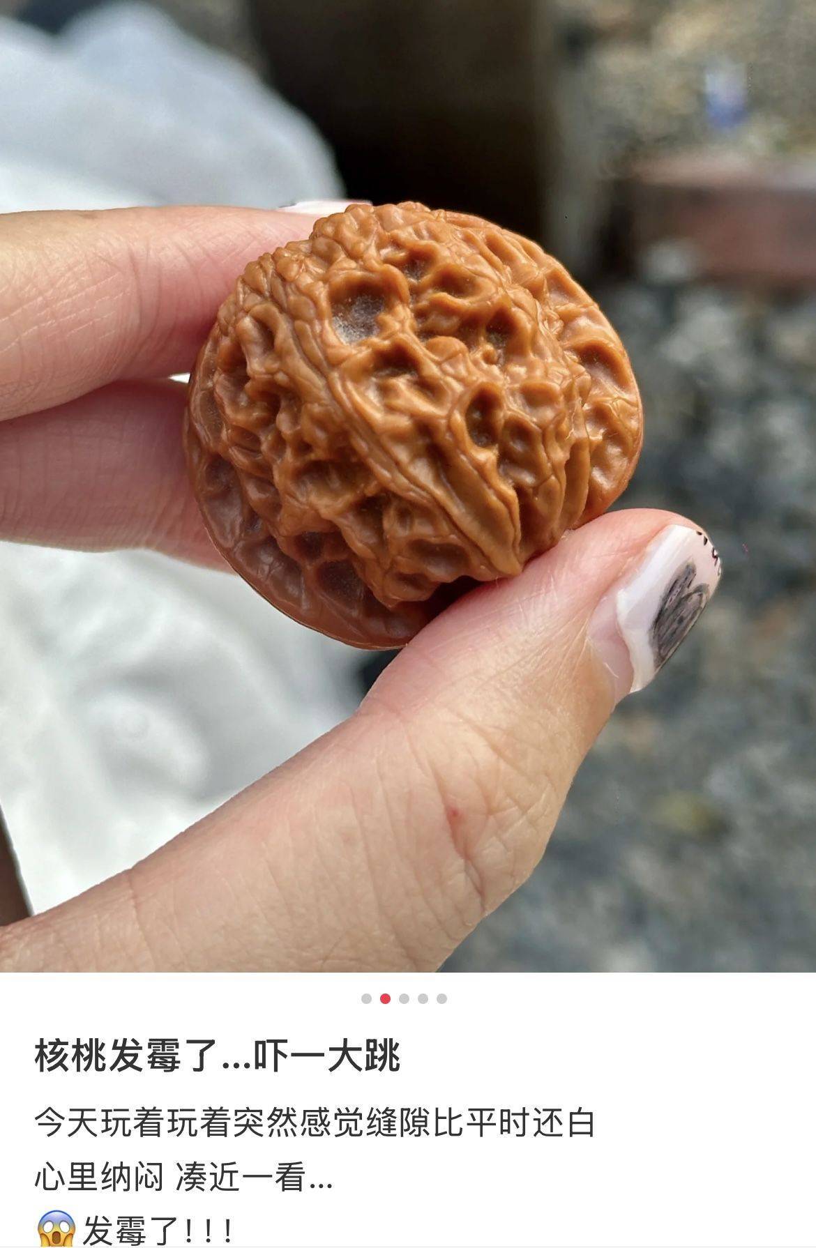 新闻多一度 | 致癌物超标9000多倍 这些“毒”首饰别再戴了